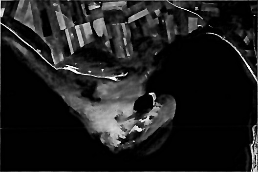 A recurved spit complex has